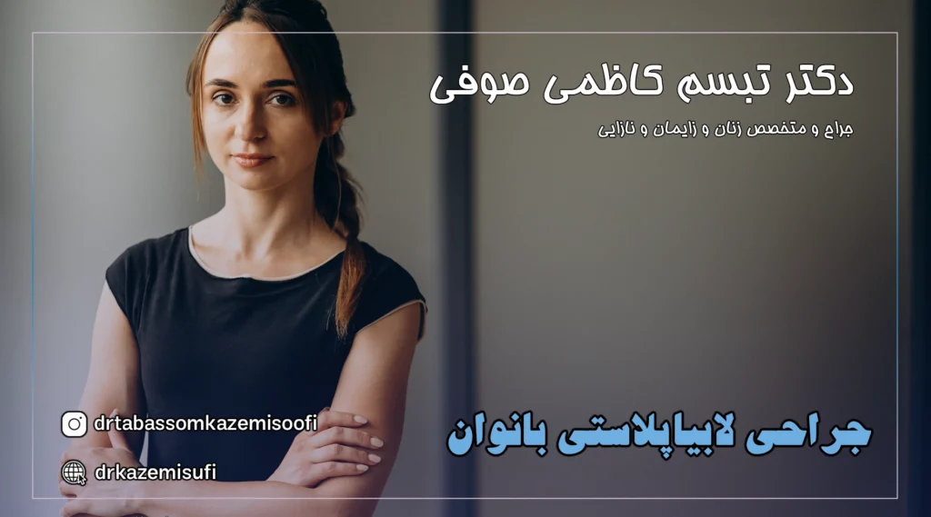 لابیاپلاستی